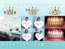 ドルチェ 水戸店(Dolce)の雰囲気（たった30分でホワイトニングケア。予約も取りやすく通いやすい♪）