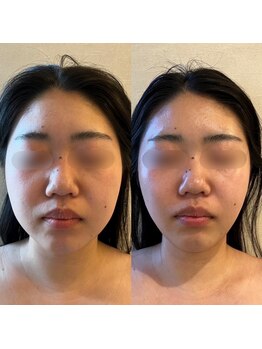 ラドンナ(LA DONNA)/韓国Oracle美容皮膚科提携機器
