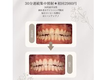 プラスビーセルフ(+b self)/ホワイトニングビフォーアフター