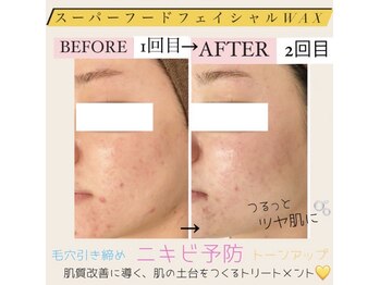 ダリア(Dahlia)/スーパーフードフェイシャルwax