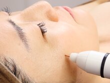 アフロディーテ(APHRODITE)/施術風景[脱毛/フェイシャル]