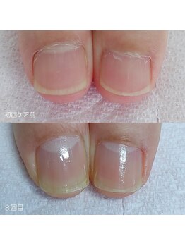 エヌプラス(Nplus)/美爪育成３ヵ月コース