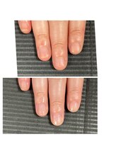 ウェルズユキ(well's yuki)/爪が弱い／爪が伸びると亀裂