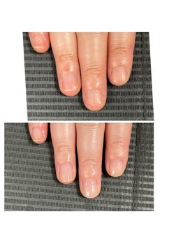 ウェルズユキ(well's yuki)/爪が弱い/爪が伸びると亀裂