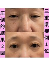 スリール(sourire)/三重県プロセル改善症例数No1