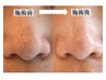 【人気No.1毛穴ケア】黒ずみ・開き・ざらつき徹底ケアコース