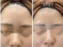 エミー(emy)の雰囲気(江坂/美白ケア/毛穴ケア/シミケア/剥離なしピーリング/たるみ)