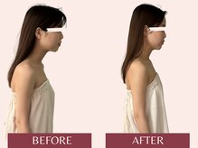 アンリール(Anrire)/【板橋/フェイシャルエステ】