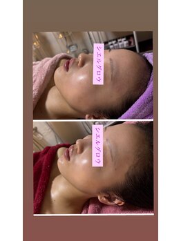 シエルグロウ(CielGrow)/★acトリートメント★