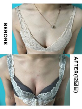 ネイト ワックス(Neit Wax)/バストアップ１２回のボリューム