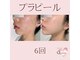 クイーン(QUEEN)の写真