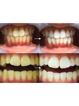 1回ごとにお支払い可能なサロン