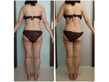 もんたわ鍼灸整骨院の雰囲気（キャビ+EMS 5回施術後◎ウエスト周りスッキリ※女性スタッフ施術）