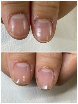 ネイルケア/ハンドケア/自爪育成