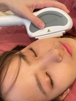 エステティックサロン さらの写真/お顔脱毛×毛穴洗浄でワントーン明るい透明感のある素肌へ◇毛穴の引き締めや小顔・リフトアップ効果も◎