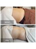 【落とせなかったおなかの脂肪を減らす】服がキレイに着れるようになる腸もみ