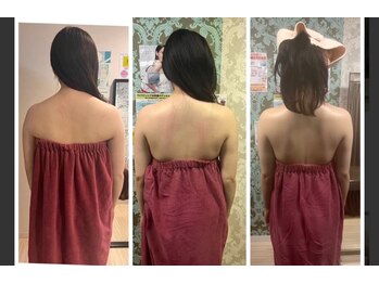 ロココ 豊田店(Rococo)/ビフォーアフター