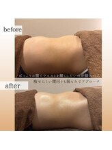 エスエー(SA)/腸もみでウエストマイナスに！