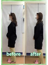 みやぎの骨盤整骨院/自律神経症状改善