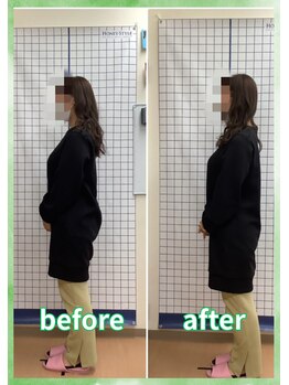 みやぎの骨盤整骨院/自律神経症状改善