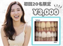 メンズアンジュ(Men's Ange)