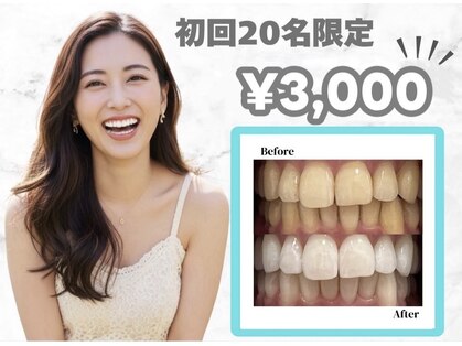 メンズアンジュ(Men's Ange)の写真