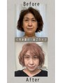 ヨサパーク かのん 幸田店(YOSA PARK) 大好きな水素吸引で美肌と尖ったあごライン首のシワも減ってる