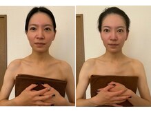 ミニマルサロン(Minimal salon)/小顔フェイシャル