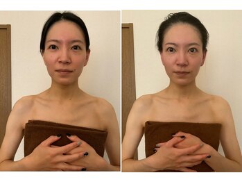 ミニマルサロン(Minimal salon)/小顔フェイシャル