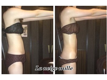 ラネージュミル(La neige mille)/インキュア痩身