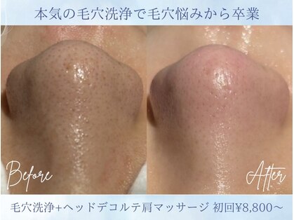 エミーニー(emiiny)の写真