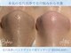 エミーニー(emiiny)の写真