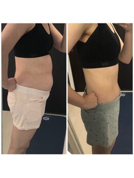 プレシャスサロン(precious salon)/6ヶ月-10キロ達成のお客様