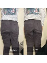 ナオル整体 池尻大橋院(NAORU整体)/骨盤のゆがみ改善<40代女性>