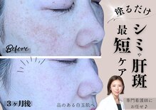 The水光美肌専科