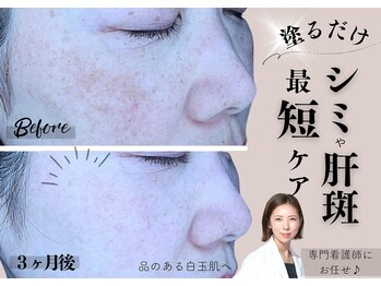 The水光美肌専科