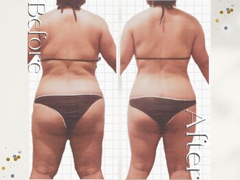 オームの森 北浜/難しい背中の贅肉も