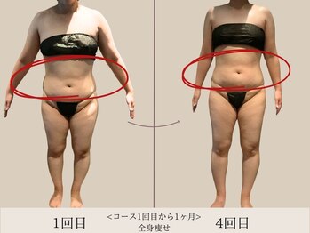 エル 麻布十番(LllL)/【痩身】1ヶ月ビフォアフ