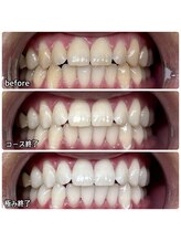 ティースペース(T-space)/極み