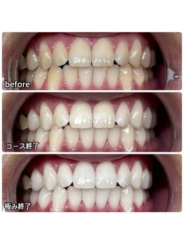 ティースペース(T-space)/極み