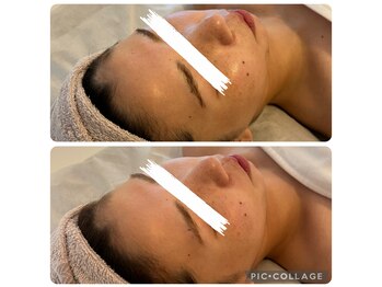 クリーンアンドビューティ 札幌(Clean&Beauty)/透明感がでるだけでこんなにも♪