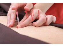 つばさ整骨院 鍼灸院 新潟女池院/（骨盤矯正/整体/腰痛/肩こり)