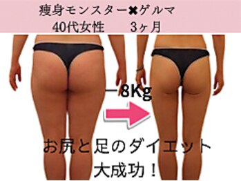 ファニービー 高槻店/症例写真