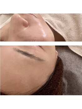 プリュムアイ フェイシャルホーム(prume eye.facial home)/艶肌