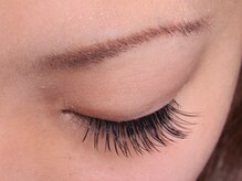 ヴィヴァーチェ 新宿店(Vivace)/施術後【２】