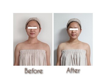 ミードット(me.)/me.コルギでお顔も鼻筋くっきり