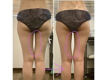 エステティックジュネス(JEUNESSE)/全身スリムマッサージ 発汗付き