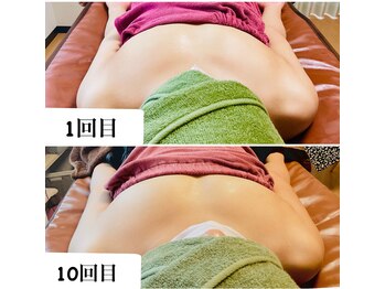 つばききよら/デコルテにボリュームが欲しい…