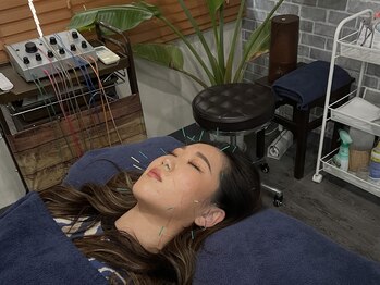 ビースタイル(B-style)/【美容鍼灸】電気美容鍼灸施術