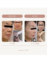 サロン メイリー(salon meili)/【メンズOK】スノーピール